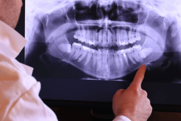Best Emergency Treatment for Dental Infections or Abscesses in Wilson, PA